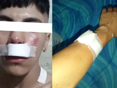 joven atacado en libertador