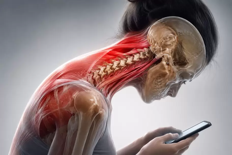 Se registran cada vez más casos de "Cuello de Texto"