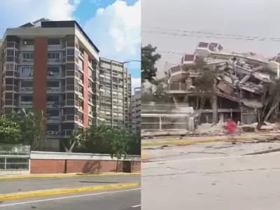 antes y despues venezuela